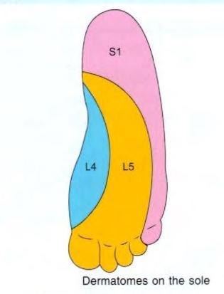 sole-dermatomes.jpg