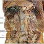 abdomen_dissection.jpg