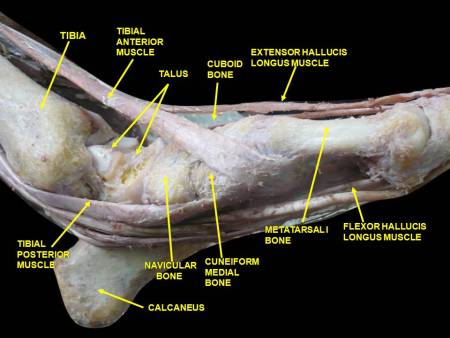 ankle-medial-view.jpeg