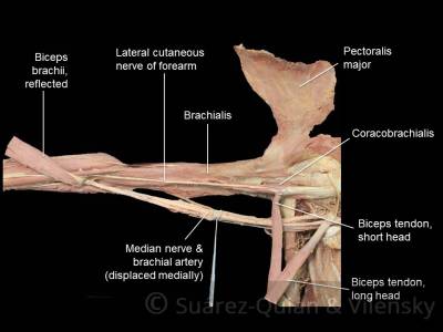 arm-anterior_-coracobrach.jpg