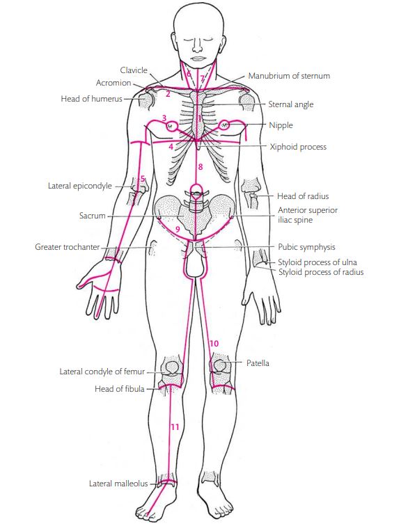 dissection_lines.jpg