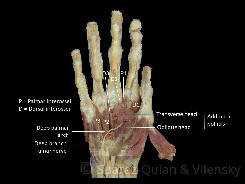 hand-muscles-interossei-and-adductor-pollicis.jpg