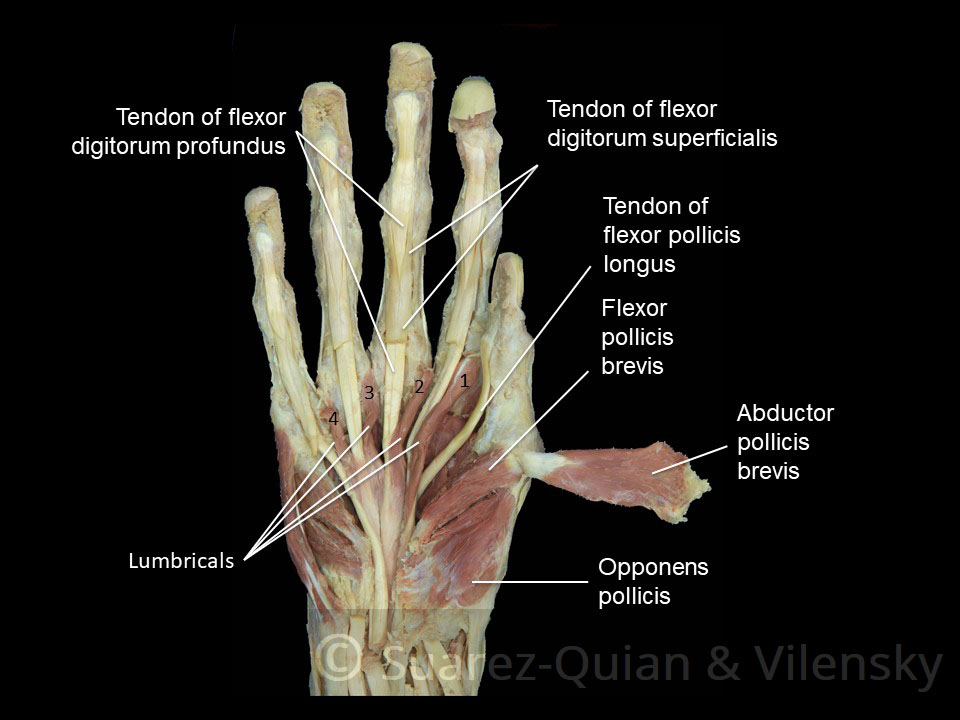 hand-muscles-lumbricals.jpg