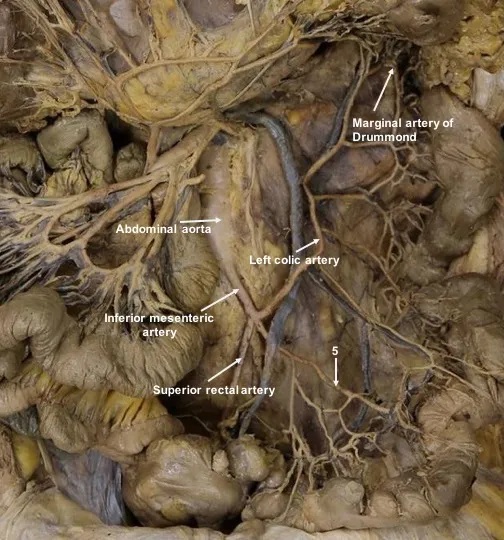 inferior-mesenteric-artery.jpg