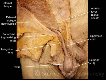 inguinal-canal-boundaries.jpg