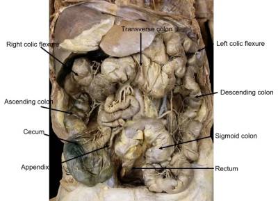 intestine-large-regions.jpg