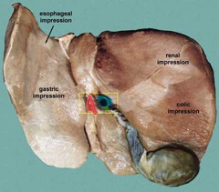 liver-inferior-impression.jpg