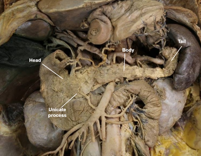 pancreas-cadaver.jpg