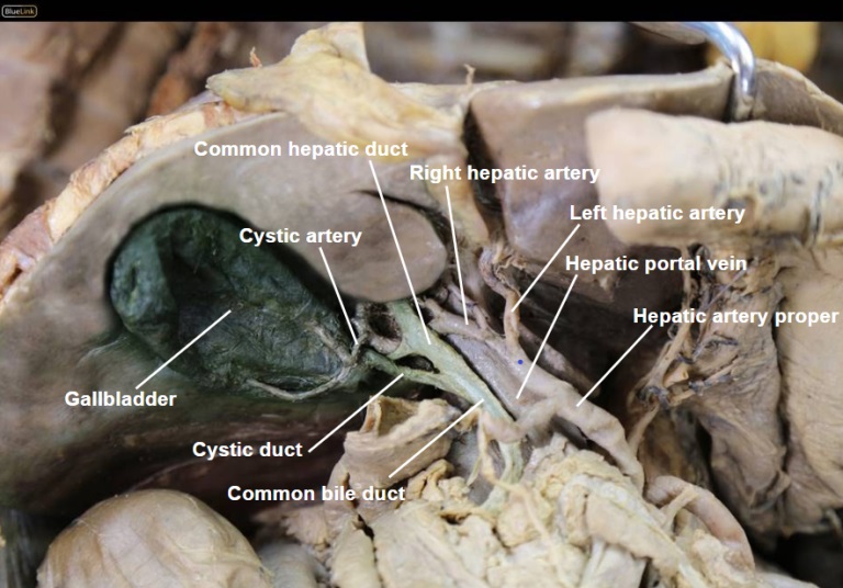 porta-hepatis-cadaver.jpg