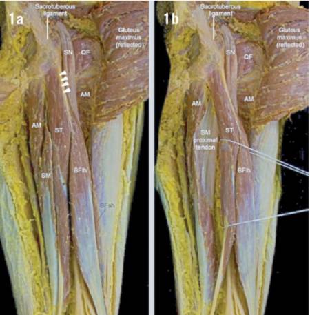 posterior-compart-thigh.jpg