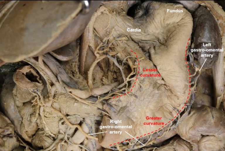 stomach-blood_supply-2.jpg