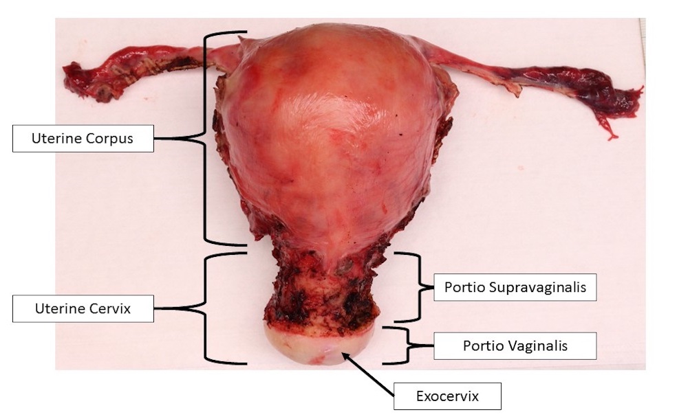 uterus-normal.jpg