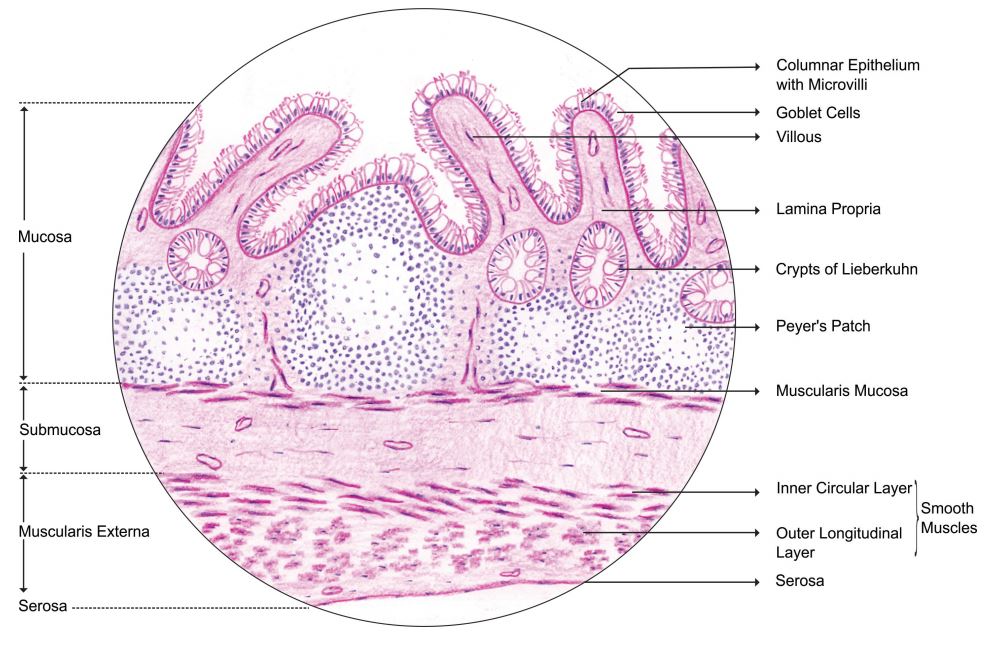 ileum.jpg