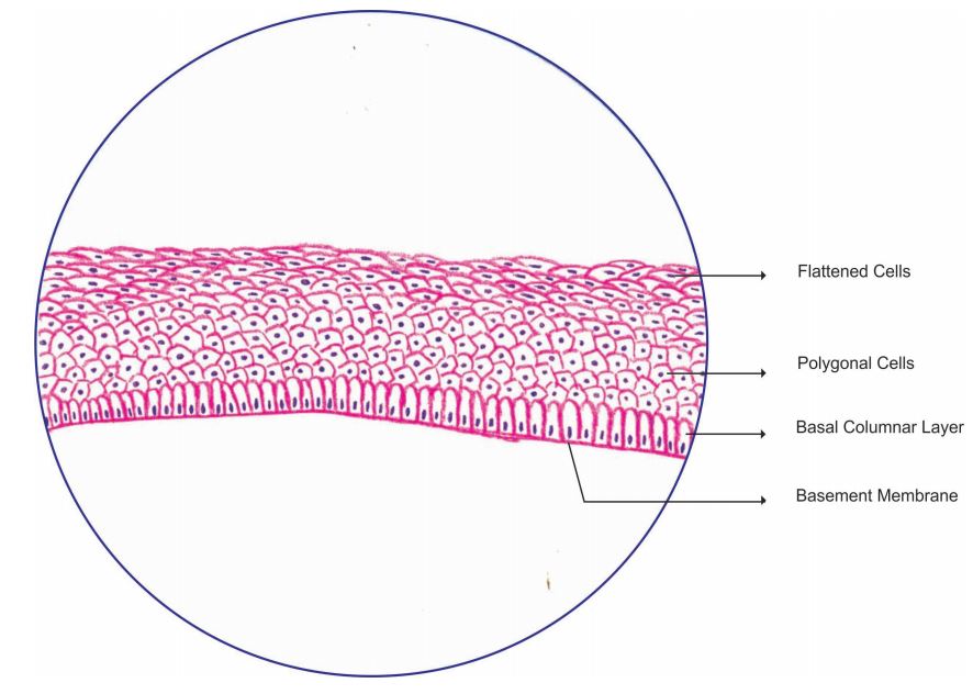 stratified-sq-non-kerat.jpg