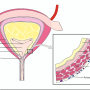 urinary-bladder-schema-histo.png