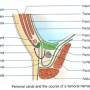 femoral-canal-hernia-course.jpg
