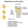 sciatic-nerve-variations.png