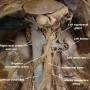 kidneys-in-situ-cadaver.jpg