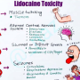 lidocaine_toxicity_mnemx.png