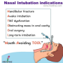 nasal_intubation_indication_mnemx.png