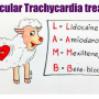 ventricular_tachycardia_mnemx.png