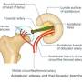 acetabular_artery.jpg