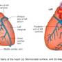 coronary-sinus.jpg