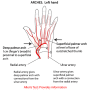 palmar-arterial-arch.png